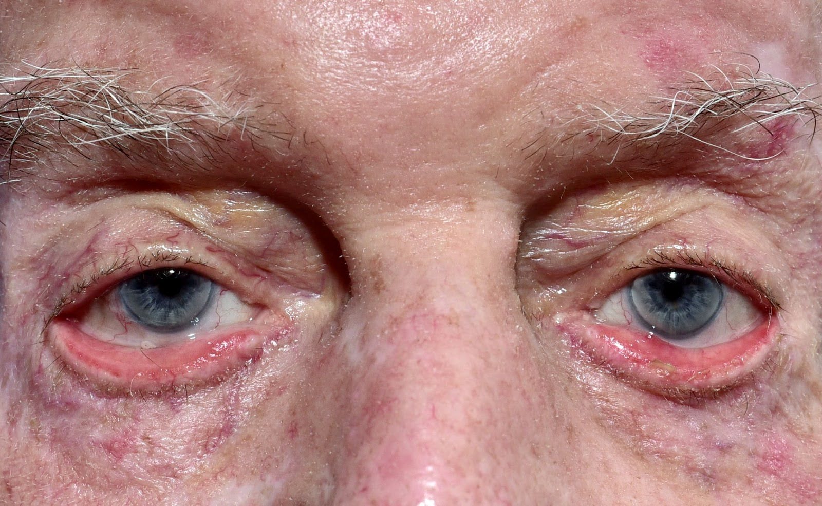 Close up of a person's eyes Description automatically generated