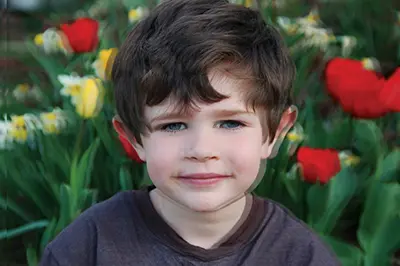 دید دوگانه در آب مروارید