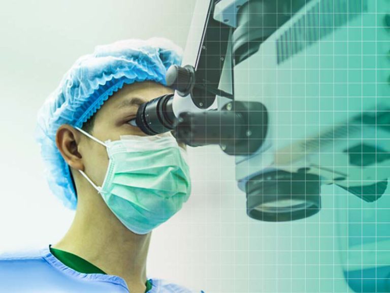 عمل حذف عینک