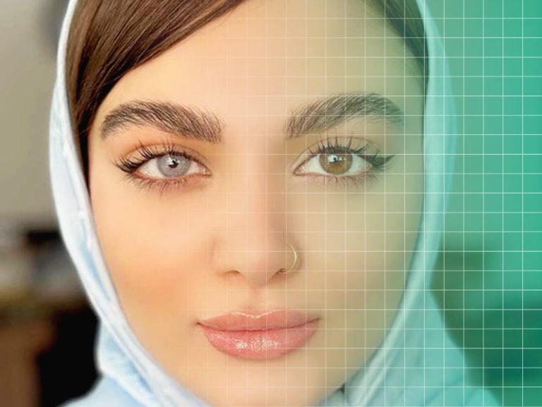 عوارض لنزهای زیبایی بر سلامت چشم