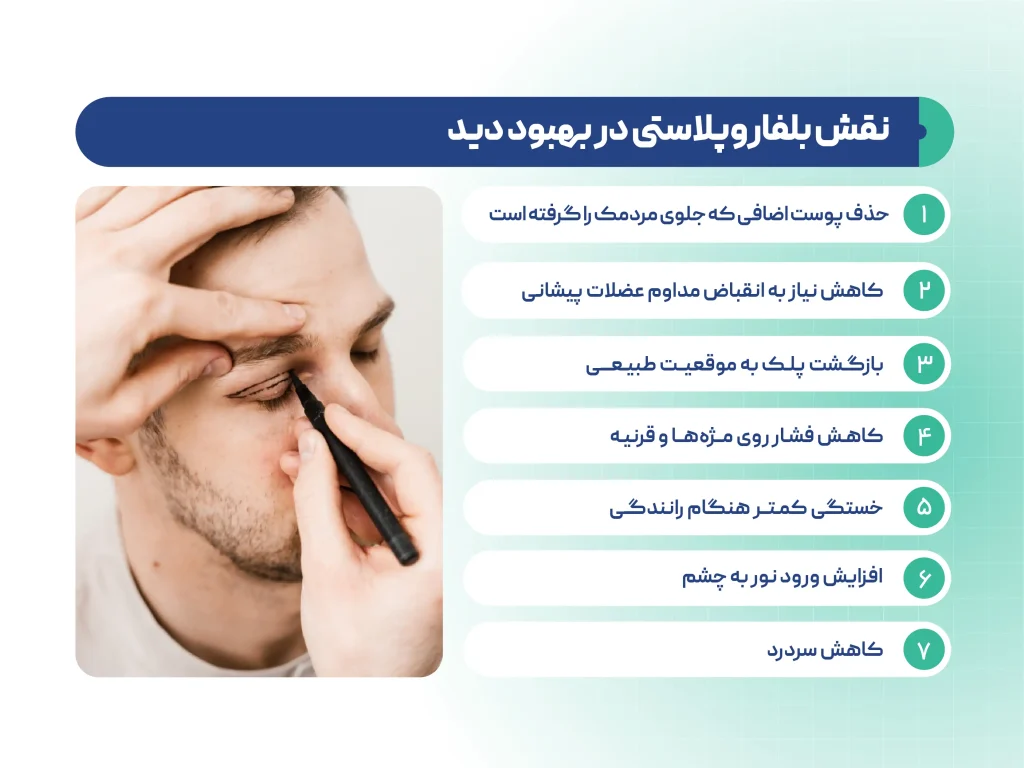 چگونه بلفاروپلاستی باعث بهبود دید میشود؟
