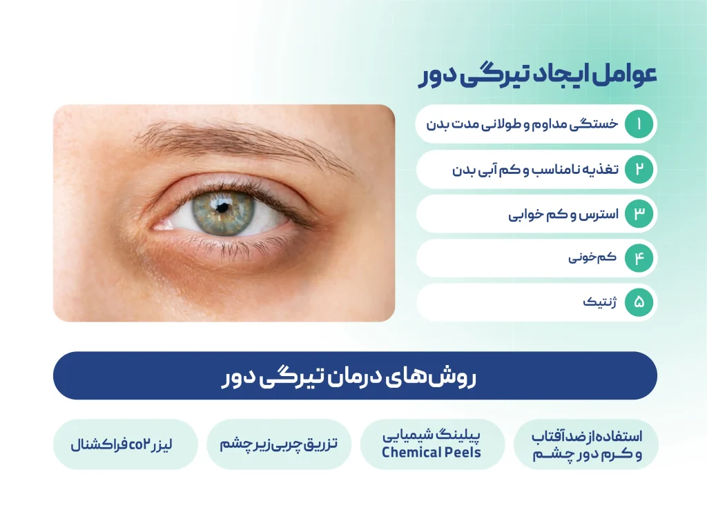 تیرگی دور چشم