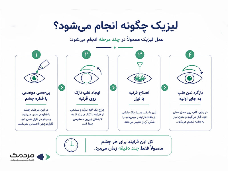 مراحل عمل لیزیک