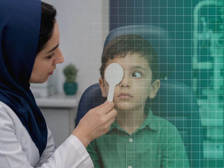 استرابیسم یا انحراف چشم چیست؟